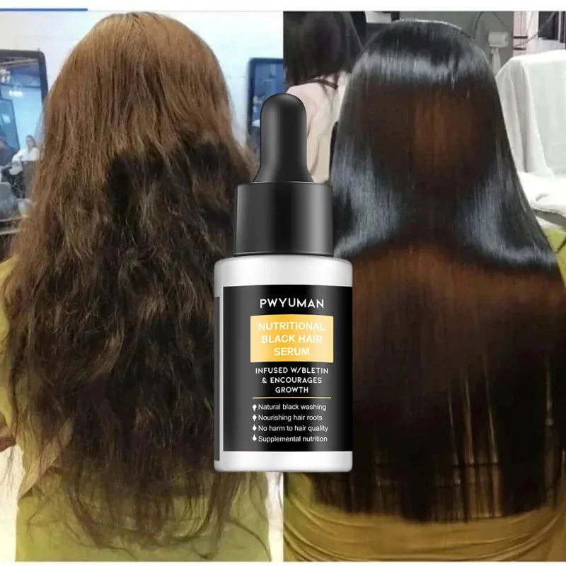 Fast Anti Dandruff Hair Treatment Soap with  Itching  Scalp repair , Cleaning Exfoliating and Antipruritic Hair Care