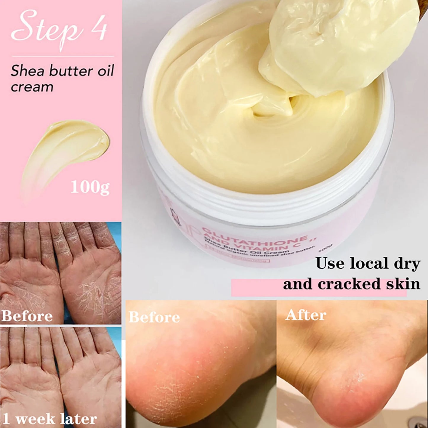 Black Spots Facial Skin Care Lotion. Moisturizing and Lightening Body Cream with  Glutathion ,